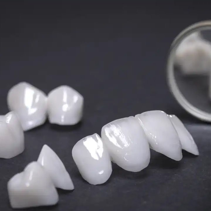 Advanced CAD/CAM digital technology used for custom dental restorations in Turkey