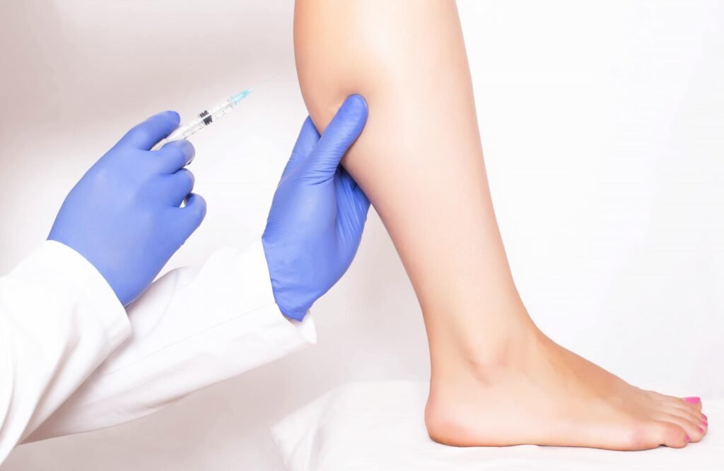 Calf Implants vs Fat Transfer: Which Is Right for Your Legs? 1 Specialized liposuction harvesting technique used to prepare fat tissue for transfer