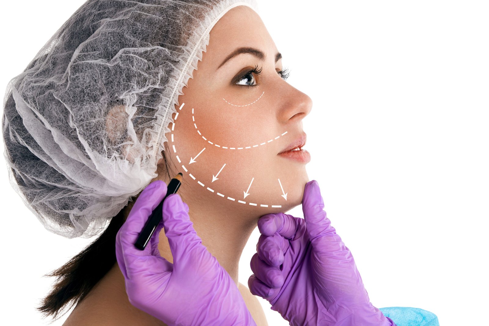Your Premier Destination for Dental, Aesthetic, Hair Transplant & Obesity Treatments in Turkey 19 Day-by-day visual progression and healing stages during mini facelift recovery