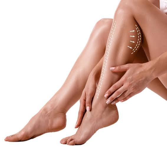 Anatomical placement of solid silicone calf implants for permanent volume enhancement