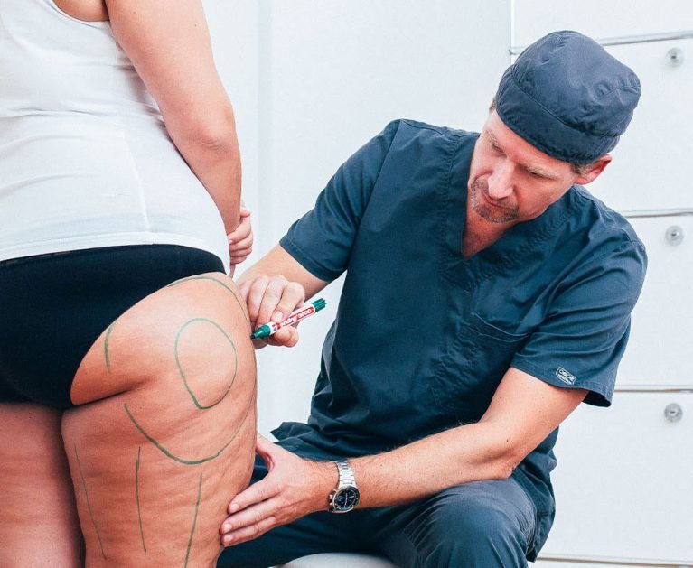 Lipedema Liposuction in Turkey: How It Differs From Cosmetic Lipo 1 High precision water assisted and ultrasound lipedema fat removal procedure preserving lymphatic vessels