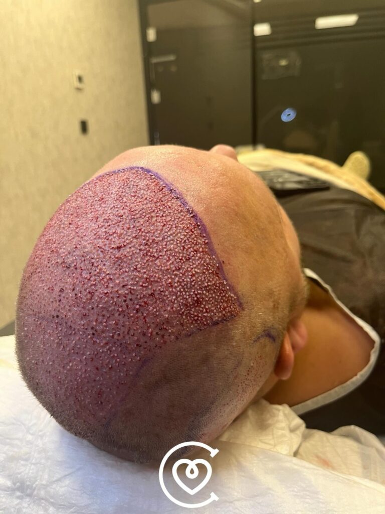 Instagram post from cayraclinic. This post is in position 3.