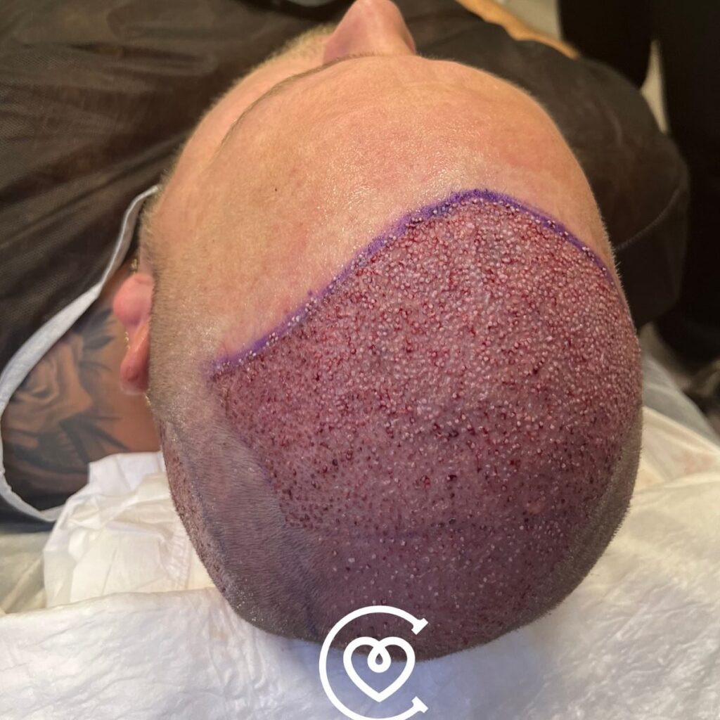 Instagram post from cayraclinic. This post is in position 2.