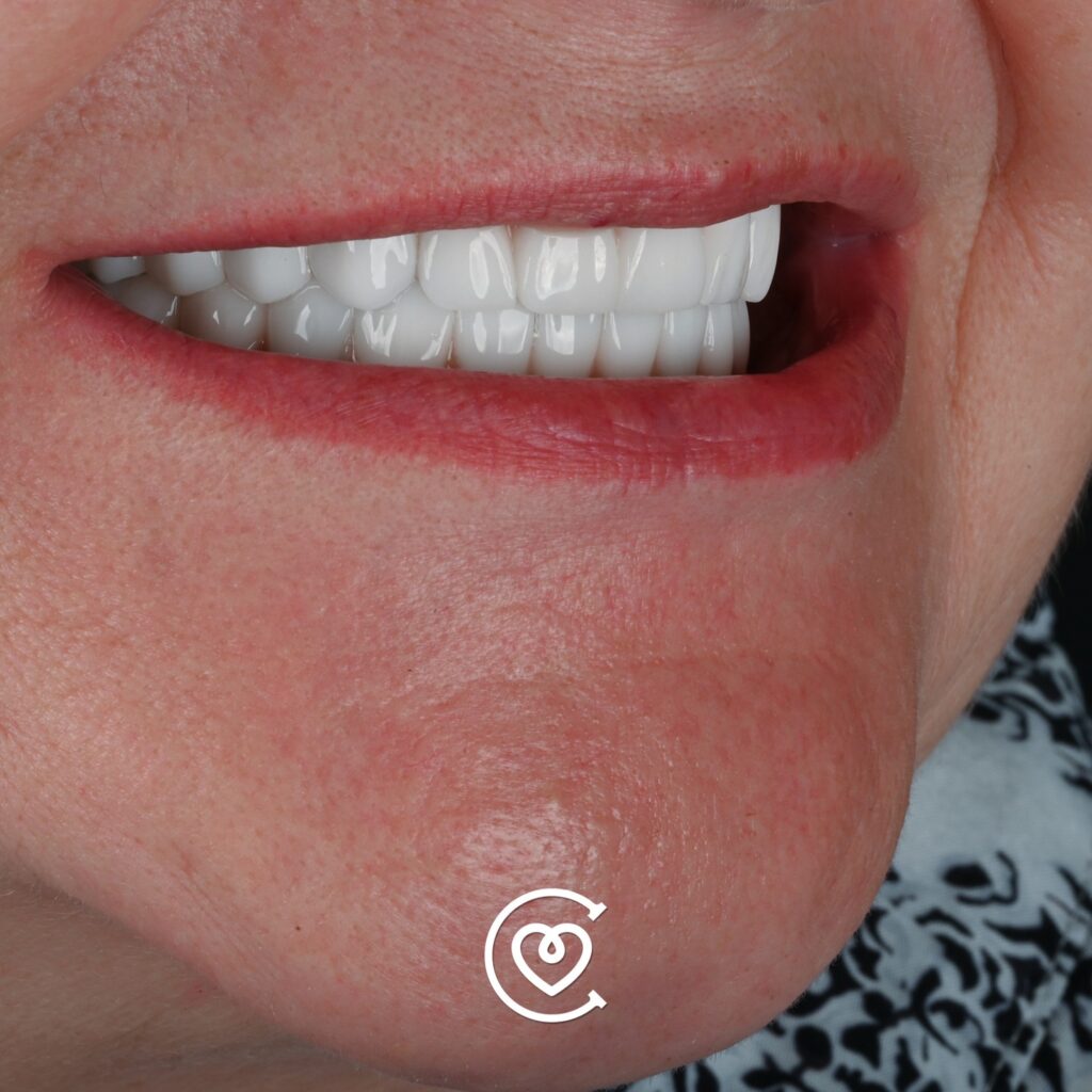 Instagram post from cayraclinic. This post is in position 2.