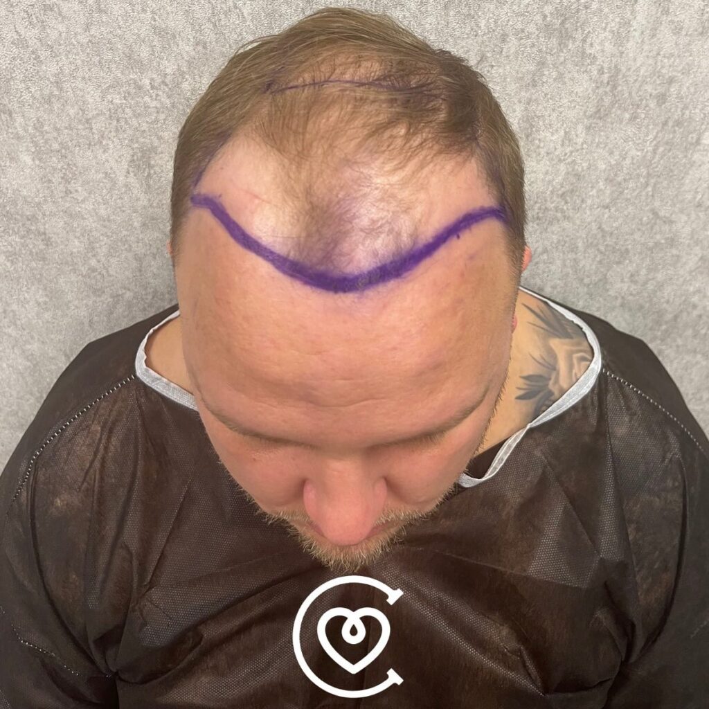 Instagram post from cayraclinic. This post is in position 1.